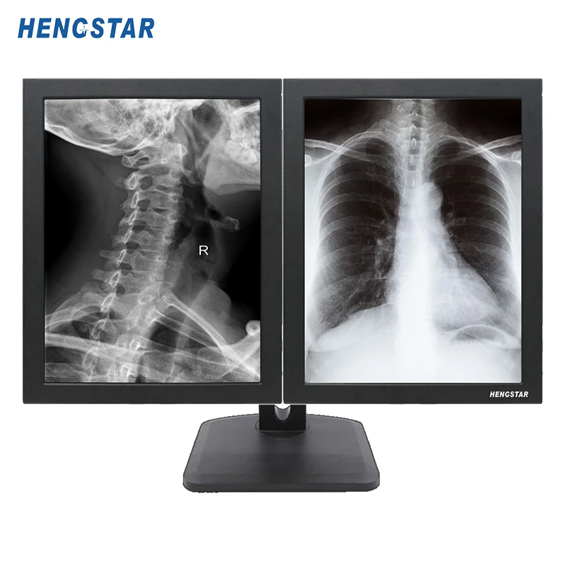 21.3 Inch 3M Medical Monitor